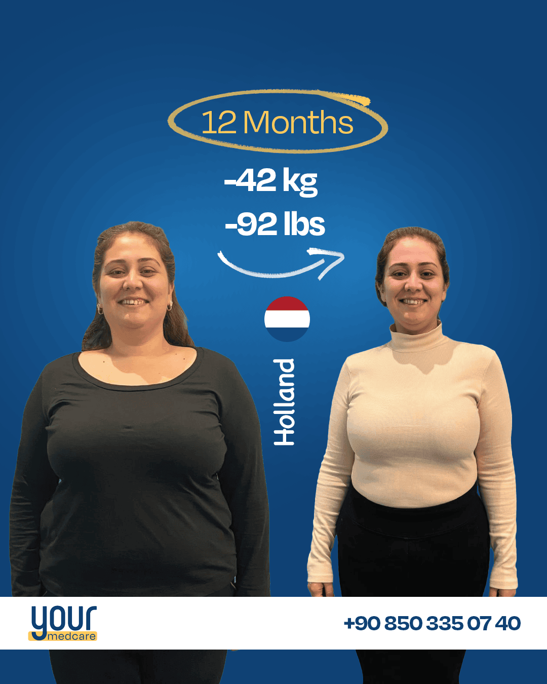 woman lost 42kg after sleeve 